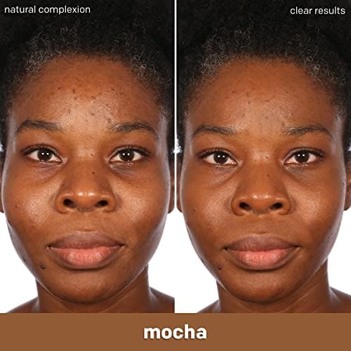 Almay Clear Complexion Acne Foundation Makeup with Salicylic Acid, Medium Coverage, Soft Matte Finish, Hypoallergenic, Cruelty- & Fragrance-Free, Dermatologist Tested, 730 Golden Caramel, 1 fl oz