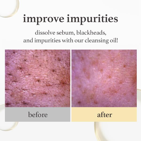 NOONI Facial Cleanser - Snow Aqua 0 LHA Toning Cleansing Oil *2ea | Makeup Blackhead Remover, Pore Control, Glass Skin, Help Control Sebum, Revitalizing, Mother's Day, 6.76 Fl Oz x 2