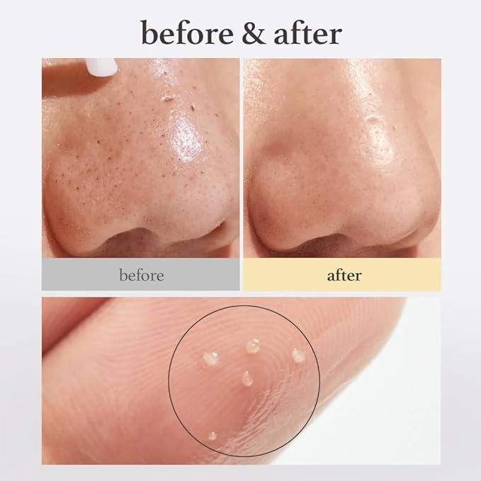NOONI Facial Cleanser - Snow Aqua 0 LHA Toning Cleansing Oil *2ea | Makeup Blackhead Remover, Pore Control, Glass Skin, Help Control Sebum, Revitalizing, Mother's Day, 6.76 Fl Oz x 2