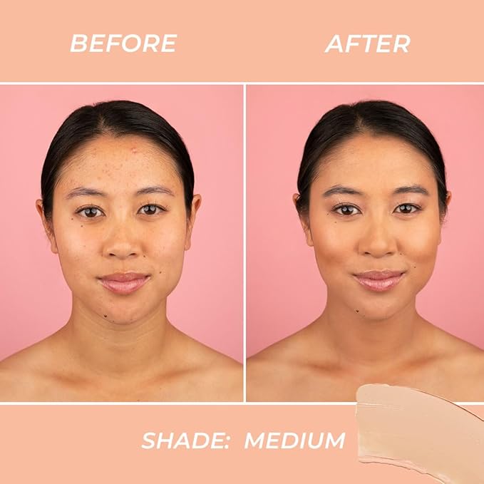MCoBeauty Miracle BB Cream, Medium, Skin-Perfecting Coverage for Effortless Beauty, Vegan, Cruelty Free Cosmetics