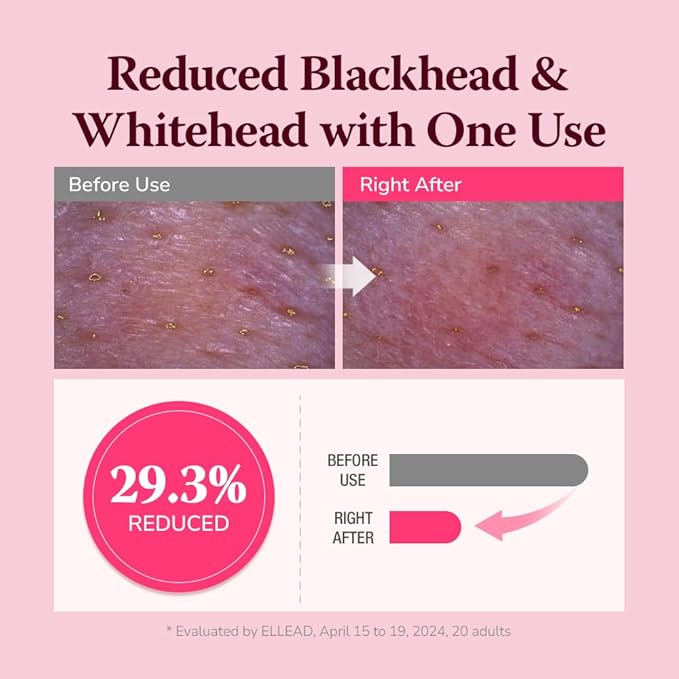 Pore & Blackhead Deep Cleansing Oil BHA, 6.7 fl oz 2 Pack - Pore Purifying Oil Cleanser with BHA for Blackhead Removal, Makeup Remover with Refreshing Low Alkaline Formula