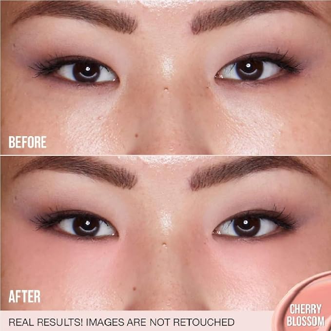 H.U.D.A BEAUTY #FAUXFILTER Under Eye Color Corrector 0.3 oz / 9 mL (Cherry Blossom, 0.3 oz / 9 ml) + Bonus Acne Patch (36 Pieces)