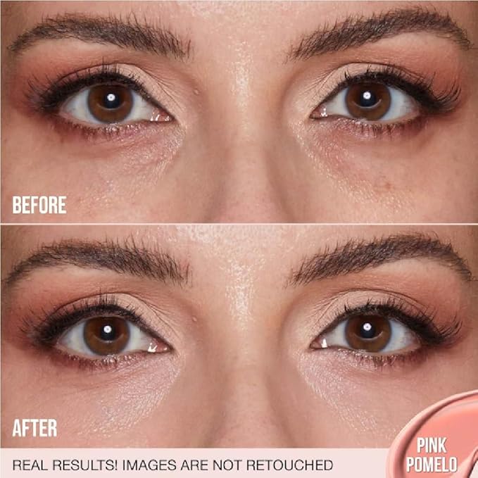 H.U.D.A BEAUTY #FAUXFILTER Under Eye Color Corrector Pink Pomelo (0.3 oz / 9 mL) + Bonus Acne Patch (36 Pieces)