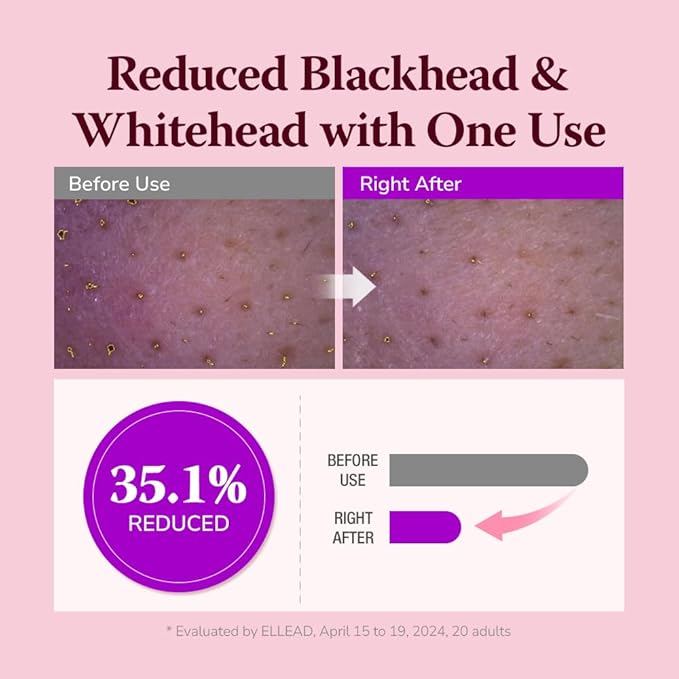Pore & Blackhead Deep Cleansing Oil PHA, 6.7 fl oz 2 Pack - Gentle Hydrating Oil Cleanser for Dry, Sensitive Skin, Low pH Makeup Blackhead Remover