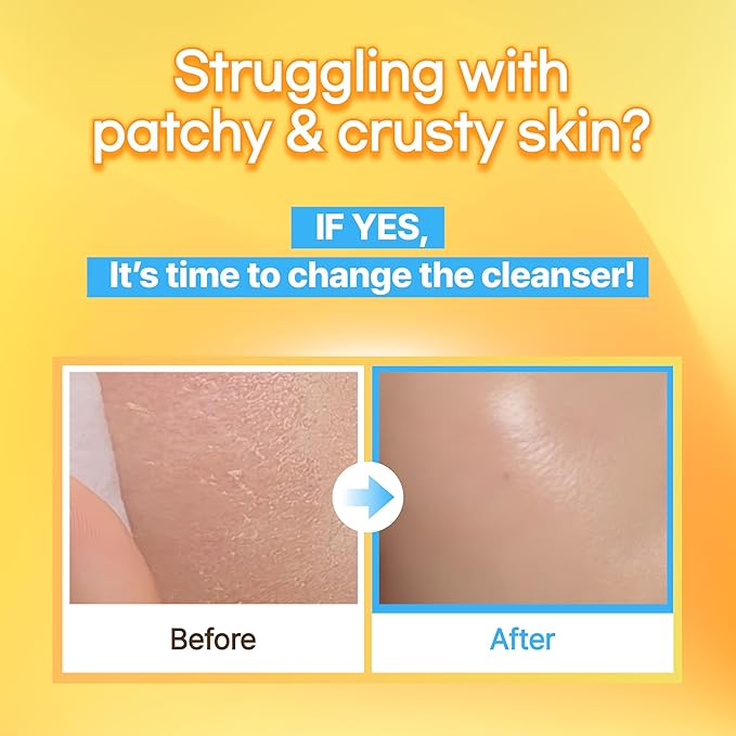 Mild but Deep Cleansing Water – Gently Exfoliates, Hydrates & Removes Makeup for Sensitive Skin, Alcohol-Free, with Micellar Technology, Korean Skincare
