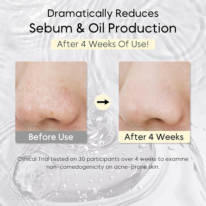 Heartleaf Pore Control Cleansing Oil Mini, Makeup Blackhead Remover, Travel Size, Korean Skin Care, Oil Cleanser for Face (20ml / 0.67 fl.oz.)