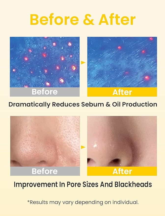 Elvira Pore Control Cleansing Oil, Makeup Remover for Sensitive, Oil Cleanser for Face, Blackhead Removal, Korean Skin care, Hydrating, Fragrance-Free