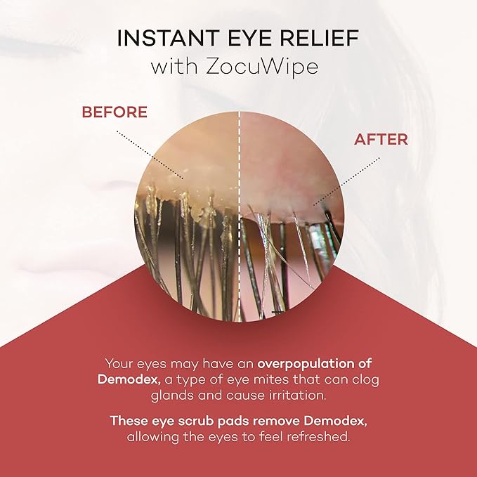 Zocuwipe Eyelid Wipes with Okra Complex - Eyelid Cleanser and Moisturizer Pads 40ct + Zocufill Elixir Eye Gel and Face Serum