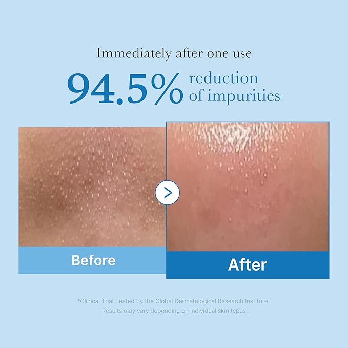 medicube Pore Care Duo for Flawless Skin: Zero Pore Blackhead Deep Cleansing Oil & Pads 2.0