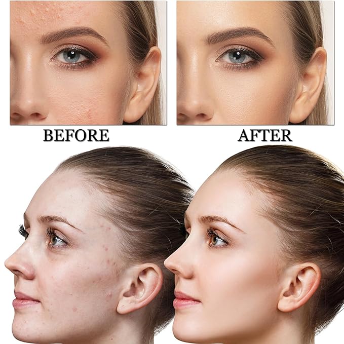 CAHIUYOA Mushroom Head Air Cushion CC Cream BB Cream Mushroom Head Foundation Full Coverage Foundation Makeup Long Lasting Moisturize Matte Concealer - 01 LIvory
