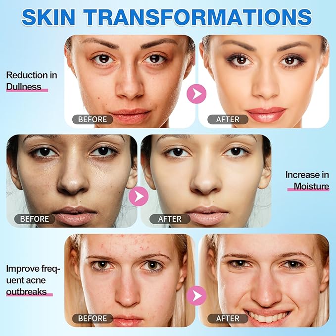 Turmeric Cleansing Pads Kojic Acid Turmeric Cleansing Pads, Face Turmeric & Kojic Acid Pads for Dark Spots, Glow Up Acne Scars, Unclog Pores, Enriched Vitamin C,Gentle & Non-Irritating