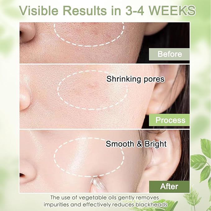 COSMOO Deep Cleansing Oil, Pore Control Oil Cleanser for Face, Makeup Blackhead Remover, Korean Skin Care, All Skin Types - 200ml ×2