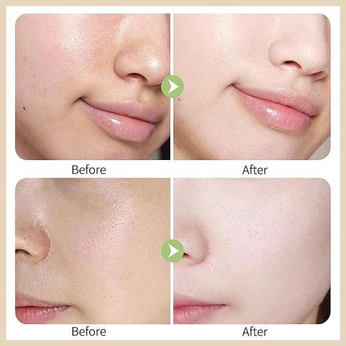 Erinde Red Correct CC Cream with Centella, Lightweight CC Cream Foundation for Mature Skin Women, Color Correcting Cream, Medium Coverage CC Cream Foundation, Natural Finish