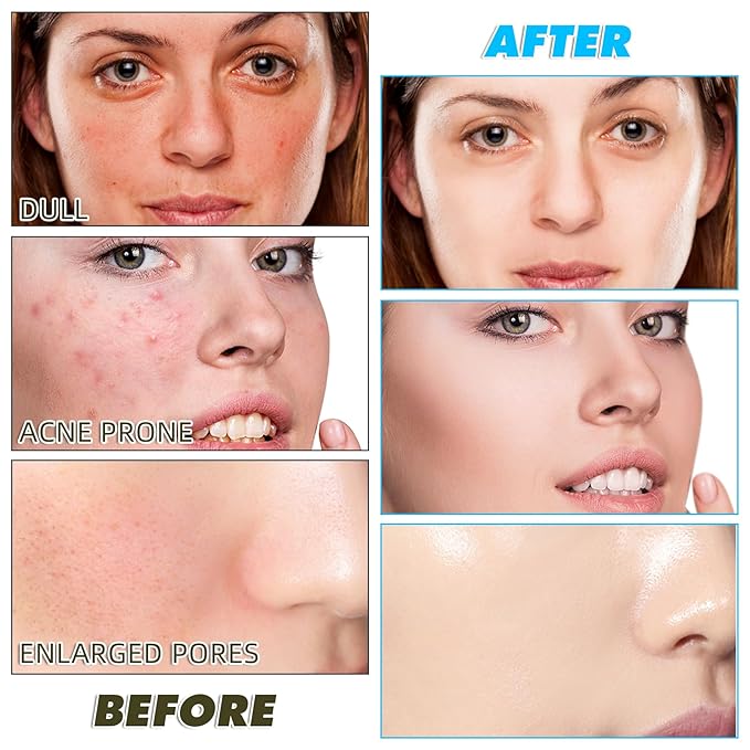 Turmeric Cleansing Pads Kojic Acid Turmeric Cleansing Pads, Face Turmeric & Kojic Acid Pads for Dark Spots, Glow Up Acne Scars, Unclog Pores, Enriched Vitamin C,Gentle & Non-Irritating