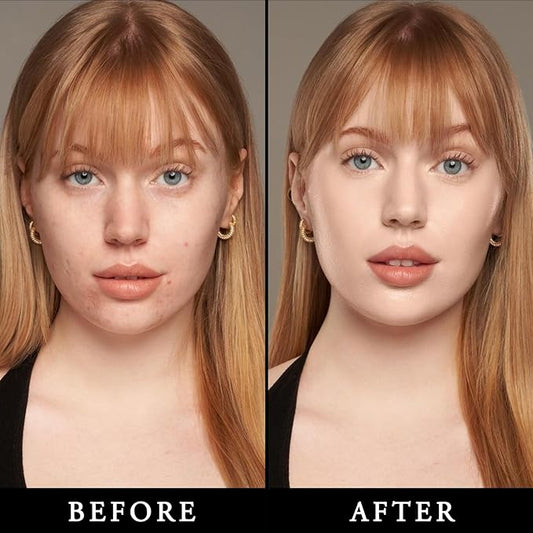 Matte Foundation Stick - Full Coverage Concealer And Contour Stick With Built In Applicator