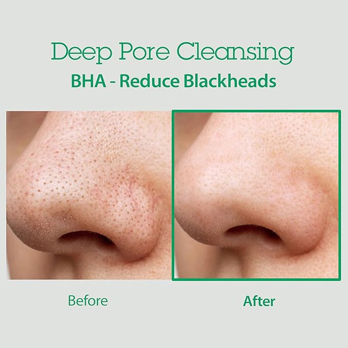 BLITHE Pore Care Duo – Cleansing Balm & AHA BHA Cleanser | Deep Pore Cleansing, Makeup Remover, Gentle Exfoliation & Hydration | Korean Skincare for Clear, Smooth Skin
