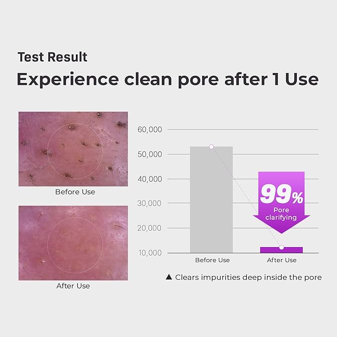 GRAFEN Cleansing Balm Makeup Remover Dermabiome - Korean Makeup Remover Balm Melt Down at Body Heat, Deep Pore Cleansing & Sebum Control, Hydrated Cleansing, One-Touch Cap & Spatula Included