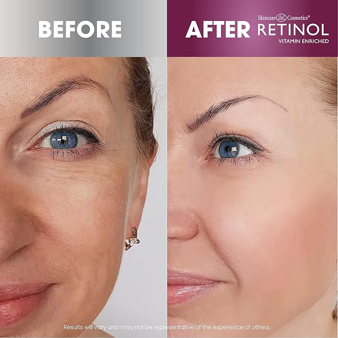 Retinol Instant Radiance Booster - Provides A Burst of Anti-Aging Hydration and Radiance + Retinol All in One Anti-Aging Cleansing Towelettes
