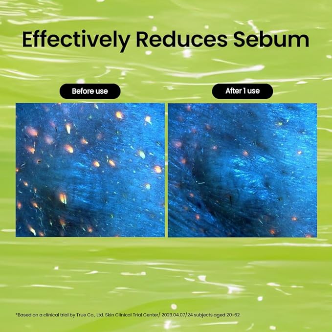 beplain Mung Bean Cleansing Oil(6.76fl.oz/200ml)| Fragrance-Free | Non-Comedogenic Tested| Makeup Blackhead Remover & Deep Pore Cleanser| Suitable for Sensitive Skin| Double Cleansing Korean Skincare