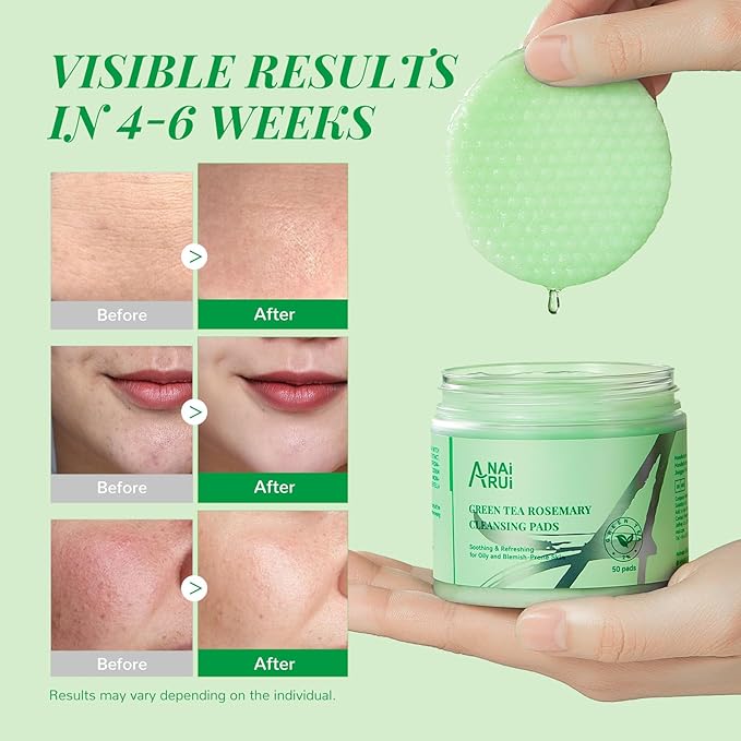 ANAI RUI Green Tea Rosemary Cleansing Pads with CICA Tea Tree Oil, Face Scrub Pads with Bubbles, Exfoliating Deep Cleansing Pad for Face and Body, Make-up Remover Wipes, 50pcs