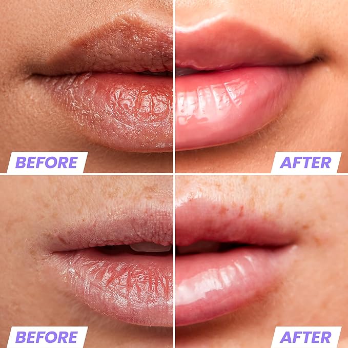 Wonderskin Lip Stain Peel Off Masque (Neon Rose) with Lip Rehab Serum Oil