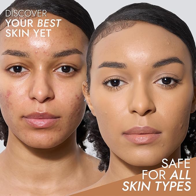 Cover FX Discoloration Kit: Total Coverage Cream Foundation - L1 + Skin Discovered Longwear Concealer, L1 - Full Coverage