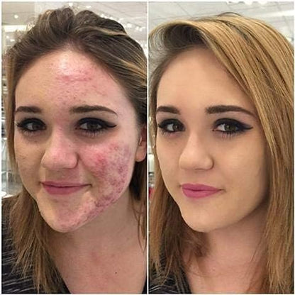 PHOERA Foundation Concealer Makeup Full Coverage Matte Brighten Long Lasting UK (106 WARM SUN)