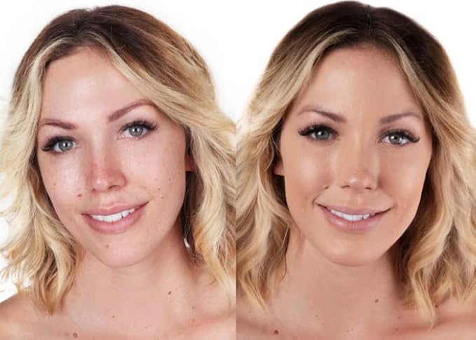 Loves-You-Back 3in1 Mineral Powder Foundation (BEIGE 1) | Designed for Rosacea, Acne-Prone, Sensitive Skin | 3IN1 Concealer, Powder + Foundation | Non-Caking, Non-Drying