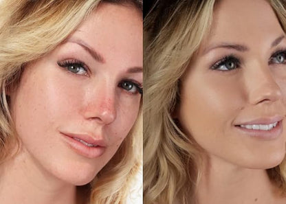 Loves-You-Back 3in1 Mineral Powder Foundation (BEIGE 1) | Designed for Rosacea, Acne-Prone, Sensitive Skin | 3IN1 Concealer, Powder + Foundation | Non-Caking, Non-Drying