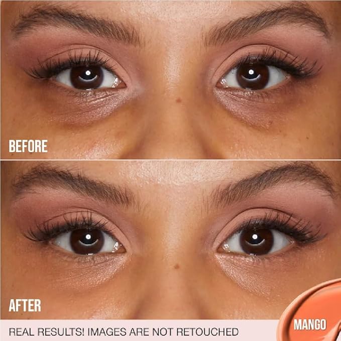 H.U.D.A BEAUTY #FAUXFILTER Under Eye Color Corrector 0.3 oz / 9 mL (Mango, 0.3 oz / 9 ml) + Bonus Acne Patch (36 Pieces)