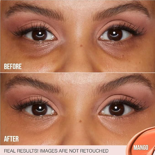 H.U.D.A BEAUTY #FAUXFILTER Under Eye Color Corrector 0.3 oz / 9 mL (Mango, 0.3 oz / 9 ml) + Bonus Acne Patch (36 Pieces)
