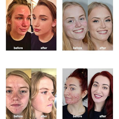 2 Pack PHOERA Foundation 101 Porcelain Makeup,Full Coverage Foundation for Women and Girls(101 Porcelain)