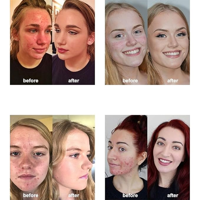 2 Pack PHOERA Foundation,Concealer Foundation Full Coverage,Flawless 24HR Matte Oil Control Concealer (102 Nude+104 Buff Beige)