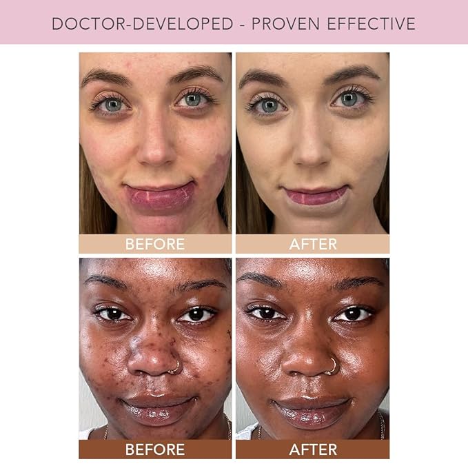 Doll 10 TCE Liquid Filter – CC Cream Foundation - Liquid Foundation - Lightweight Tinted Moisturizer & Skin Tint - Blurs Pores & Fine Lines - Vegan - Clean Makeup - [Light/Medium] - 30 Day Supply
