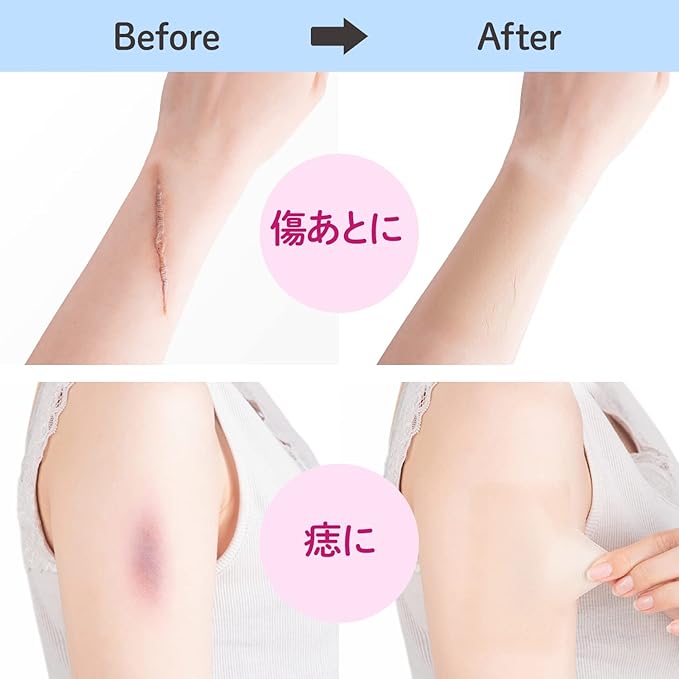 [CLASSE]Seal Concealer, Cover Up tape, Made in Japan, ultra-thin 0.015mm, different sizes, natural coverage, Waterproof, Sweatproof, for Hiding Tattoo and Scars, (B10 Milky, M size, 8 pieces)
