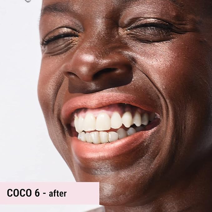 Loves-You-Back 3in1 Mineral Powder Foundation (COCO 6) | Designed for acne-prone, sensitive skin | Lightweight Coverage for hyperpigmentation + marks | Concealer, Foundation + Powder