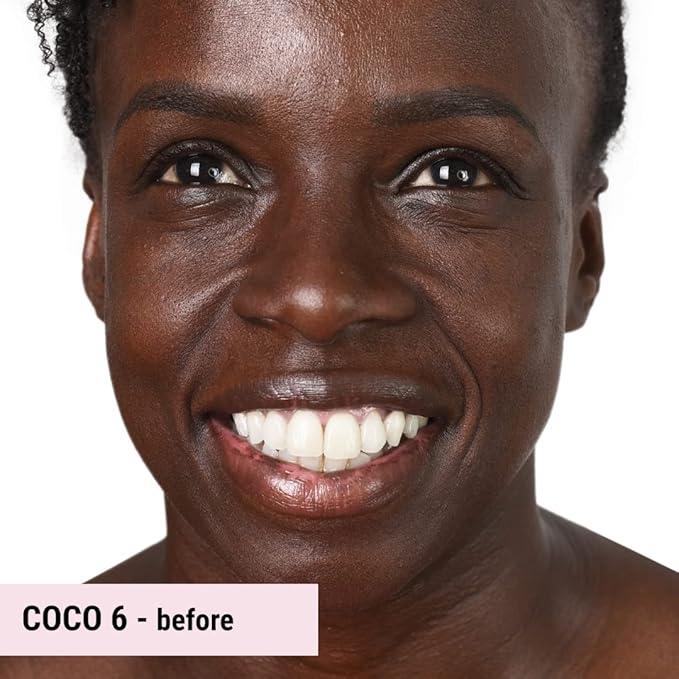 Loves-You-Back 3in1 Mineral Powder Foundation (COCO 6) | Designed for acne-prone, sensitive skin | Lightweight Coverage for hyperpigmentation + marks | Concealer, Foundation + Powder