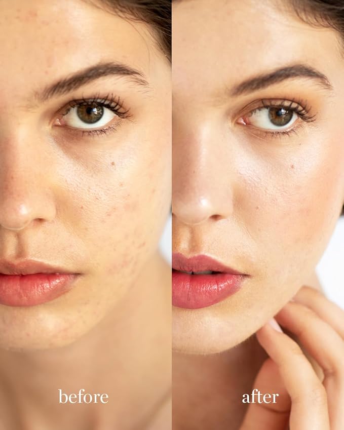 Ere Perez - Natural Oat Milk Liquid Foundation | Breathable, Buildable, Med-Full Coverage, Dewy | Peach Extract, Vitamin E | Vegan, Cruelty-Free, Clean Beauty (Honey | light warm, 1 fl oz | 30 ml)