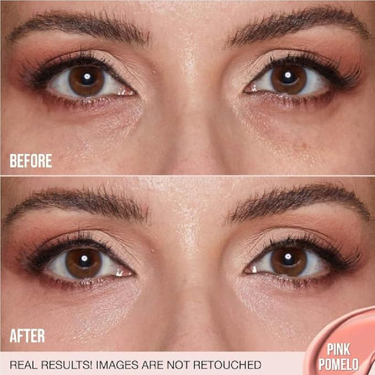 H.U.D.A BEAUTY #FAUXFILTER Under Eye Color Corrector Pink Pomelo (0.3 oz / 9 mL) + Bonus Acne Patch (36 Pieces)