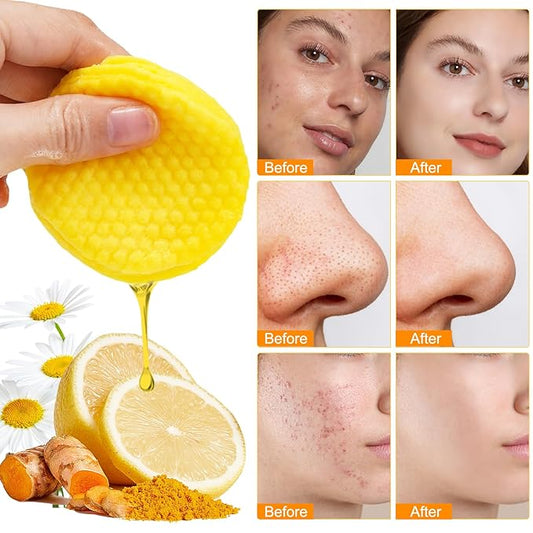 Turmeric Cleansing Pads, 50PCS Kojic Acid and Turmeric Cleansing Pads, Face Pads with Vitamin B5、Vitamin C 、Turmeric ，Remove Excess Keratin Balance Skin Oil And Water for Women