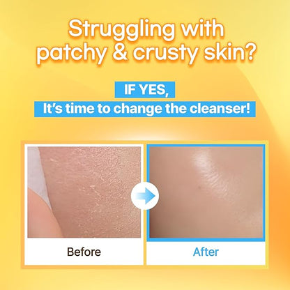 Mild but Deep Cleansing Water – Gently Exfoliates, Hydrates & Removes Makeup for Sensitive Skin, Alcohol-Free, with Micellar Technology, Korean Skincare