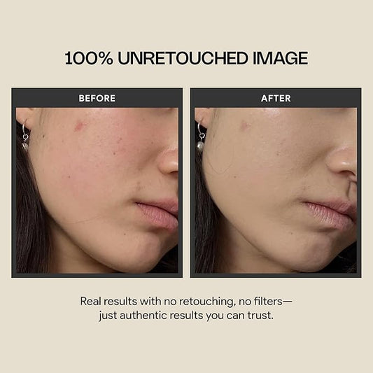 Meebak Cica Redness Solution Cream Lite | Redness Relief | Green Color-Corrector | CC Cream w/Niacinamide | Tinted Moisturizer - Fair to Medium Skin