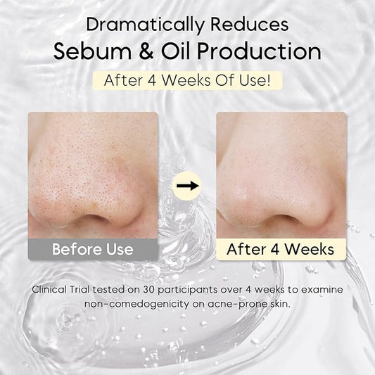 Heartleaf Pore Control Cleansing Oil Mini, Makeup Blackhead Remover, Travel Size, Korean Skin Care, Oil Cleanser for Face (20ml / 0.67 fl.oz.)