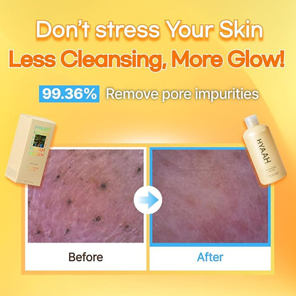 Mild but Deep Cleansing Water – Gently Exfoliates, Hydrates & Removes Makeup for Sensitive Skin, Alcohol-Free, with Micellar Technology, Korean Skincare