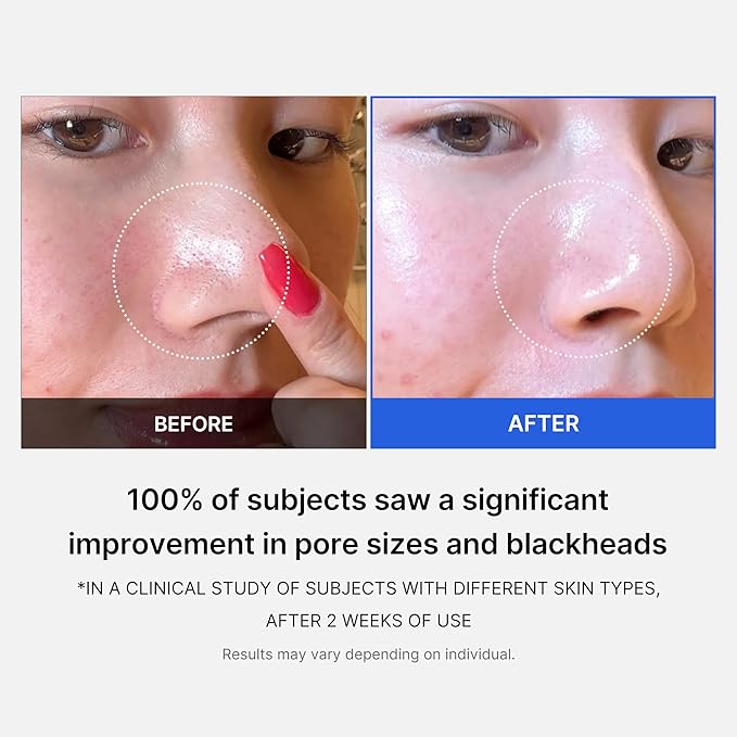 medicube Pore Care Duo for Flawless Skin: Zero Pore Blackhead Deep Cleansing Oil & Pads 2.0