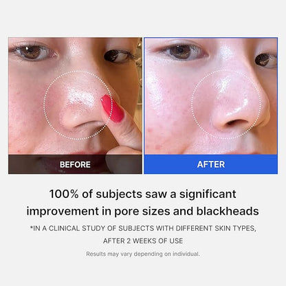 medicube Pore Care Duo for Flawless Skin: Zero Pore Blackhead Deep Cleansing Oil & Pads 2.0