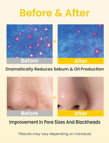 Elvira Pore Control Cleansing Oil, Makeup Remover for Sensitive, Oil Cleanser for Face, Blackhead Removal, Korean Skin care, Hydrating, Fragrance-Free