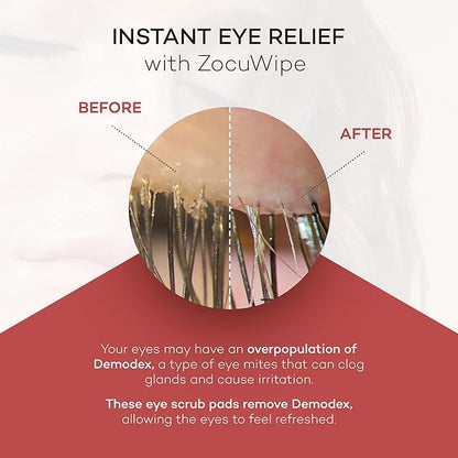 Zocuwipe Eyelid Wipes with Okra Complex - Eyelid Cleanser and Moisturizer Pads 40ct + Zocufill Elixir Eye Gel and Face Serum