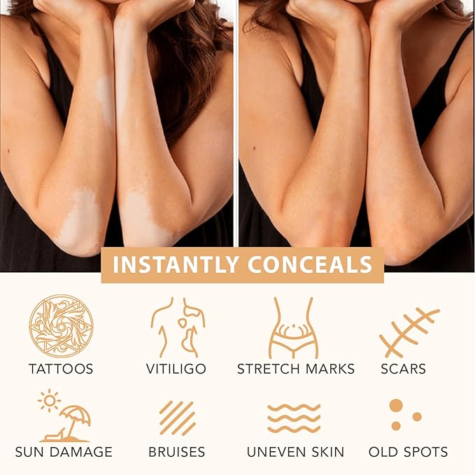 Waterproof Leg and Body Makeup, Long Lasting Skin Perfecting Body Foundation, No Transfer Vein Cover Up for Varicose Veins, Black Skin, Scars, Tattoos#Medium Glow 4FL OZ