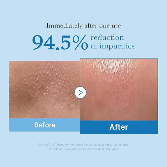 medicube Pore Care Duo for Flawless Skin: Zero Pore Blackhead Deep Cleansing Oil & Pads 2.0